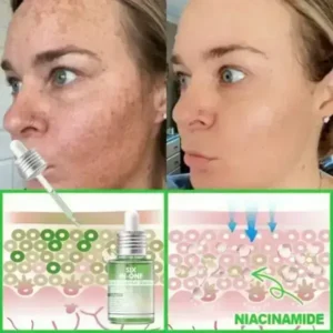 𝐎𝐫𝐢𝐚𝐜𝐡® 𝐀𝟏𝟎+ 𝟔-𝐢𝐧-𝟏 𝐃𝐞𝐫𝐦𝐚𝐑𝐞𝐩𝐚𝐢𝐫 𝐒𝐞𝐫𝐮𝐦 𝐅𝐃𝐀 𝐂𝐞𝐫𝐭𝐢𝐟𝐢𝐞𝐝 – 𝐅𝐢𝐫𝐦𝐬 𝐥𝐨𝐨𝐬𝐞 𝐬𝐤𝐢𝐧, 𝐟𝐚𝐝𝐞𝐬 𝐛𝐫𝐮𝐢𝐬𝐢𝐧𝐠 𝐚𝐧𝐝 𝐬𝐞𝐧𝐢𝐥𝐞 𝐩𝐮𝐫𝐩𝐮𝐫𝐚, 𝐚𝐧𝐝 𝐢𝐦𝐩𝐫𝐨𝐯𝐞𝐬 𝐤𝐞𝐫𝐚𝐭𝐢𝐧 𝐛𝐮𝐢𝐥𝐝𝐮𝐩, 𝐬𝐞𝐛𝐨𝐫𝐫𝐡𝐞𝐢𝐜 𝐝𝐞𝐫𝐦𝐚𝐭𝐢𝐭𝐢𝐬, 𝐚𝐧𝐝 𝐟𝐨𝐥𝐥𝐢𝐜𝐮𝐥𝐚𝐫 𝐤𝐞𝐫𝐚𝐭𝐨𝐬𝐢𝐬.