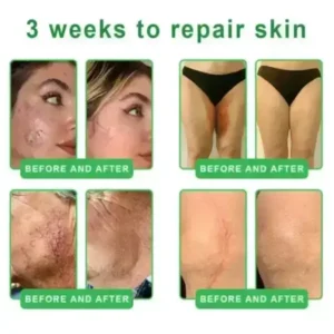 𝐎𝐫𝐢𝐚𝐜𝐡® 𝐀𝟏𝟎+ 𝟔-𝐢𝐧-𝟏 𝐃𝐞𝐫𝐦𝐚𝐑𝐞𝐩𝐚𝐢𝐫 𝐒𝐞𝐫𝐮𝐦 𝐅𝐃𝐀 𝐂𝐞𝐫𝐭𝐢𝐟𝐢𝐞𝐝 – 𝐅𝐢𝐫𝐦𝐬 𝐥𝐨𝐨𝐬𝐞 𝐬𝐤𝐢𝐧, 𝐟𝐚𝐝𝐞𝐬 𝐛𝐫𝐮𝐢𝐬𝐢𝐧𝐠 𝐚𝐧𝐝 𝐬𝐞𝐧𝐢𝐥𝐞 𝐩𝐮𝐫𝐩𝐮𝐫𝐚, 𝐚𝐧𝐝 𝐢𝐦𝐩𝐫𝐨𝐯𝐞𝐬 𝐤𝐞𝐫𝐚𝐭𝐢𝐧 𝐛𝐮𝐢𝐥𝐝𝐮𝐩, 𝐬𝐞𝐛𝐨𝐫𝐫𝐡𝐞𝐢𝐜 𝐝𝐞𝐫𝐦𝐚𝐭𝐢𝐭𝐢𝐬, 𝐚𝐧𝐝 𝐟𝐨𝐥𝐥𝐢𝐜𝐮𝐥𝐚𝐫 𝐤𝐞𝐫𝐚𝐭𝐨𝐬𝐢𝐬.