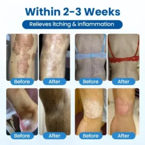 Cougex® PCA Magnesium Deep Repair Spray