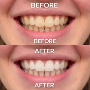 CLEZYRA Purple Teeth Whitening Strips