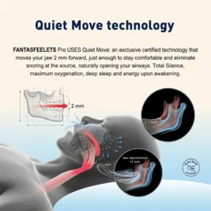 🔥Hot Sale 60% off🔥 FANTASFEELETS™ Professional intelligent anti-snoring device