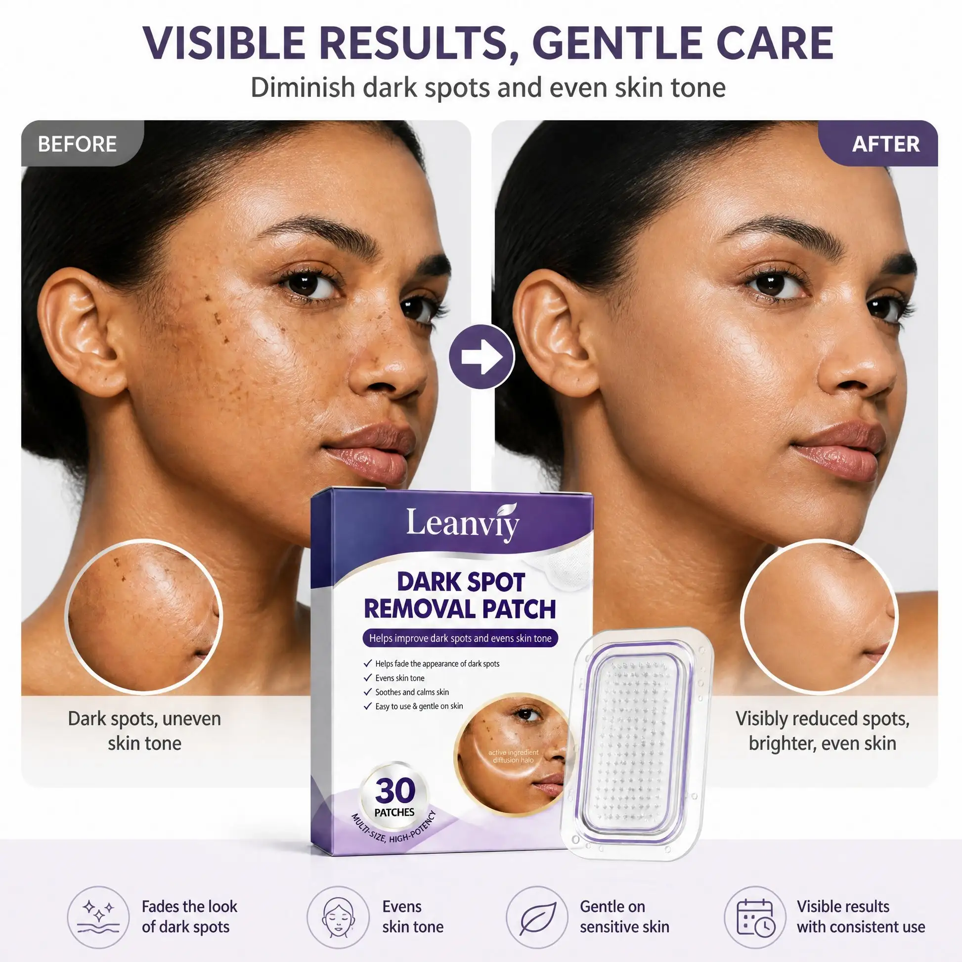 Leanviy Dark Spot Removal Patch|Nano Microneedle Technology · Visible Results in 7 Days