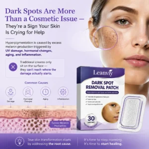 Leanviy Dark Spot Removal Patch|Nano Microneedle Technology · Visible Results in 7 Days