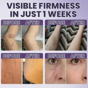LIMETOW® Bruise Repair & Skin-Strengthening Cream