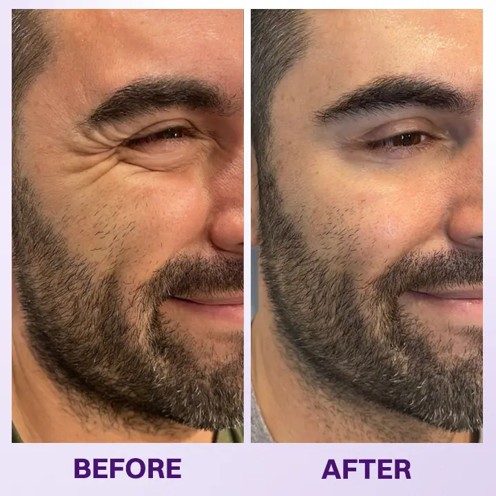 LIMETOW® Instant Lift Eye Gel