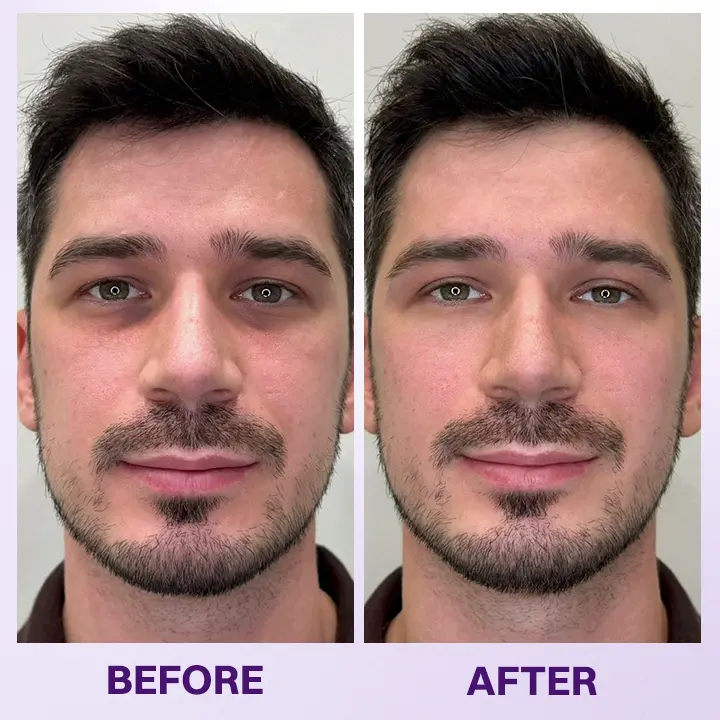 LIMETOW® Instant Lift Eye Gel