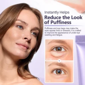 LIMETOW® Instant Lift Eye Gel