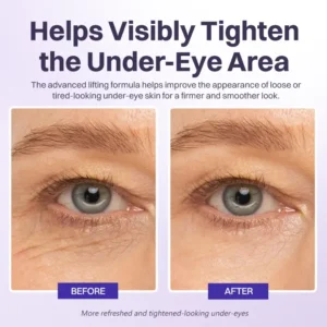 LIMETOW® Instant Lift Eye Gel